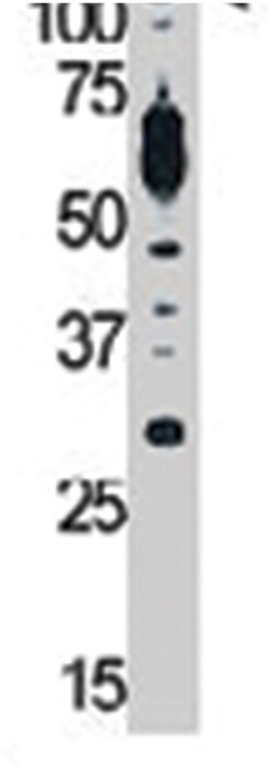 PIK3CD Rabbit anti-Human, Polyclonal Antibody, Abnova 400&mu;L; Unlabeled:Antibodies,