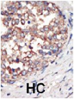 PIK3CG Rabbit anti-Human, Polyclonal Antibody, Abnova 400 &mu;L | Buy Online | Abnova Corporation | Fisher Scientific