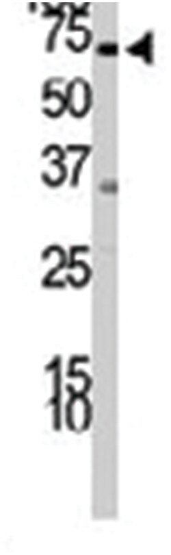 PIK3R2 Rabbit anti-Human, Polyclonal Antibody, Abnova 400&mu;L; Unlabeled:Antibodies,