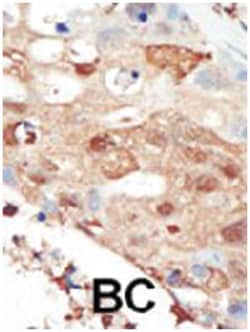 PIK3R2 Rabbit anti-Human, Polyclonal Antibody, Abnova 400&mu;L; Unlabeled:Antibodies,