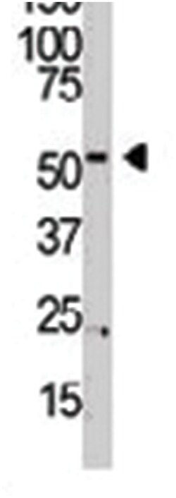 PI4K2B Rabbit anti-Human, Polyclonal Antibody, Abnova 400&mu;L; Unlabeled:Antibodies,