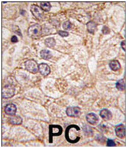 PI4K2B Rabbit anti-Human, Polyclonal Antibody, Abnova 400&mu;L; Unlabeled:Antibodies,