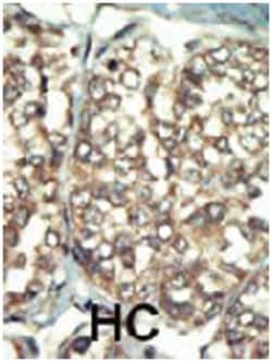 PI4K2B Rabbit anti-Human, Mouse, Polyclonal Antibody, Abnova 400 &mu;L | Buy Online | Abnova | Fisher Scientific