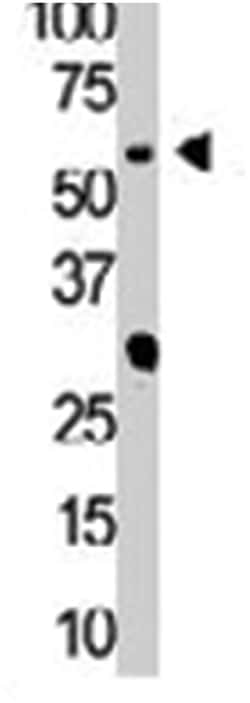 PIP5K1A, Rabbit, Polyclonal Antibody, Abnova 400&mu;L; Unlabeled:Antibodies,