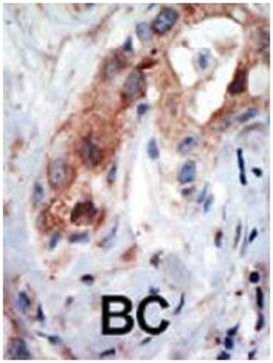 PIP5K1B, Rabbit, Polyclonal Antibody, Abnova 400 &mu;L | Buy Online | Abnova Corporation | Fisher Scientific