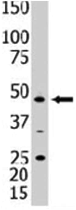 PIP4K2A Rabbit anti-Human, Mouse, Polyclonal Antibody, Abnova 400&mu;L;