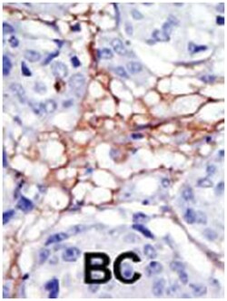 PIP4K2A Rabbit anti-Human, Mouse, Polyclonal Antibody, Abnova 400&mu;L;