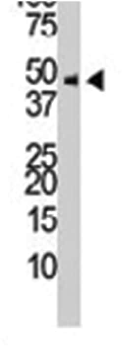 PIP4K2C, Rabbit, Polyclonal Antibody, Abnova 400 &mu;L | Buy Online | Abnova Corporation | Fisher Scientific
