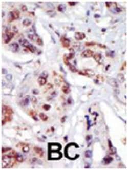 PIP4K2C, Rabbit, Polyclonal Antibody, Abnova 400 &mu;L | Buy Online | Abnova Corporation | Fisher Scientific