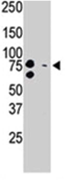 BRD3, Rabbit, Polyclonal Antibody, Abnova 400 &mu;L | Buy Online | Abnova Corporation | Fisher Scientific