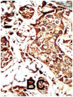 BRD3, Rabbit, Polyclonal Antibody, Abnova 400 &mu;L | Buy Online | Abnova Corporation | Fisher Scientific