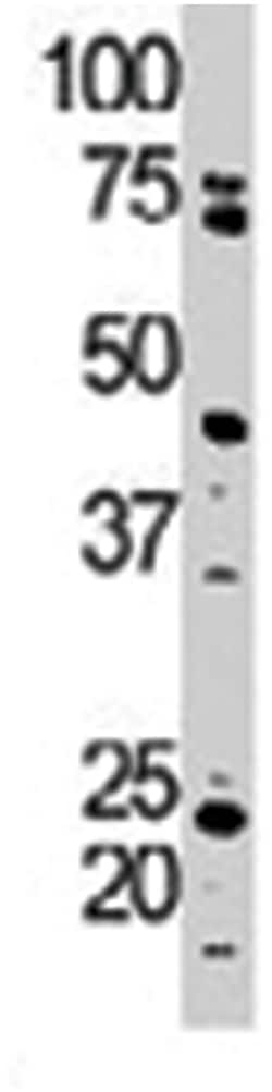TRPM7 Rabbit anti-Human, Polyclonal Antibody, Abnova 400&mu;L; Unlabeled:Antibodies,
