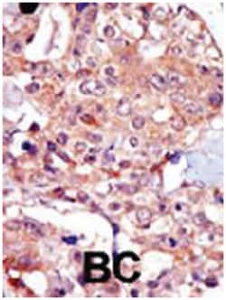 TRPM7 Rabbit anti-Human, Polyclonal Antibody, Abnova 400&mu;L; Unlabeled:Antibodies,