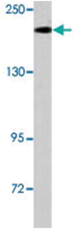 TRPM7 Rabbit anti-Human, Polyclonal Antibody, Abnova 400 &mu;L | Buy Online | Abnova Corporation | Fisher Scientific