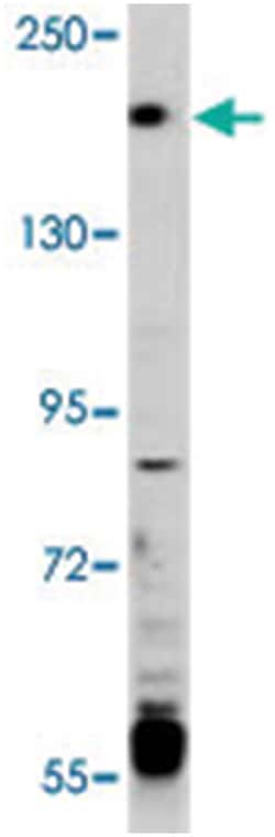 TRPM6, Rabbit, Polyclonal Antibody, Abnova 400 &mu;L | Buy Online | Abnova Corporation | Fisher Scientific