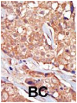 TRPM6, Rabbit, Polyclonal Antibody, Abnova 400 &mu;L | Buy Online | Abnova Corporation | Fisher Scientific