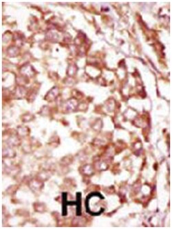 BUB1B Rabbit anti-Human, Polyclonal Antibody, Abnova 400&mu;L; Unlabeled:Antibodies,