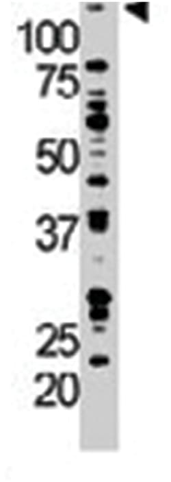 DGKZ, Rabbit, Polyclonal Antibody, Abnova 400 &mu;L | Buy Online | Abnova Corporation | Fisher Scientific