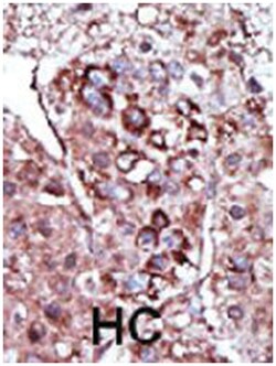 DGKZ, Rabbit, Polyclonal Antibody, Abnova 400 &mu;L | Buy Online | Abnova Corporation | Fisher Scientific
