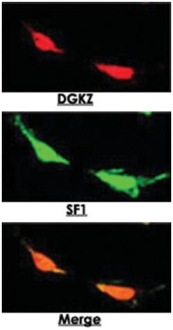 DGKZ, Rabbit, Polyclonal Antibody, Abnova 400 &mu;L | Buy Online | Abnova Corporation | Fisher Scientific