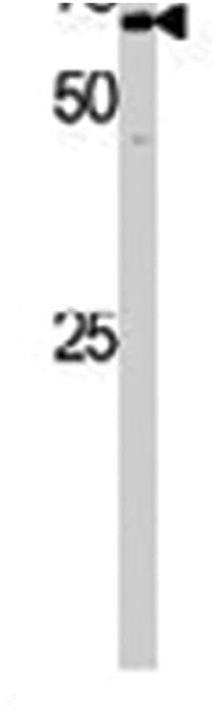 GAK Rabbit anti-Human, Mouse, Polyclonal Antibody, Abnova 400 &mu;L | Buy Online | Abnova Corporation | Fisher Scientific