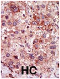 GAK Rabbit anti-Human, Mouse, Polyclonal Antibody, Abnova 400 &mu;L | Buy Online | Abnova Corporation | Fisher Scientific