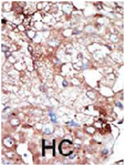 GAK Rabbit anti-Human, Polyclonal Antibody, Abnova 400 &mu;L | Buy Online | Abnova Corporation | Fisher Scientific