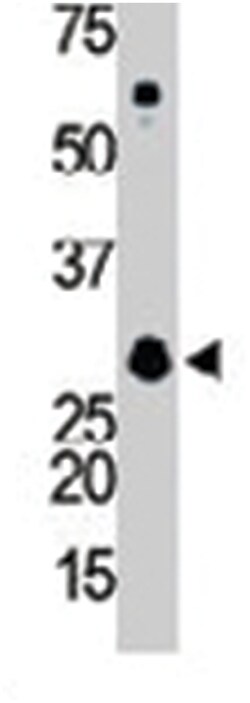 GNB2L1 Rabbit anti-Human, Polyclonal Antibody, Abnova 400 &mu;L | Buy Online | Abnova Corporation | Fisher Scientific