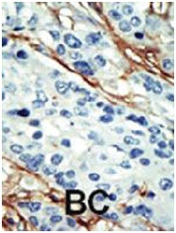 NUAK1 Rabbit anti-Human, Mouse, Polyclonal Antibody, Abnova 400 &mu;L | Buy Online | Abnova Corporation | Fisher Scientific