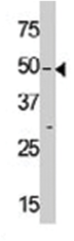 ZAK (MLKLAK), Rabbit, Polyclonal Antibody, Abnova 400&mu;L; Unlabeled:Antibodies,