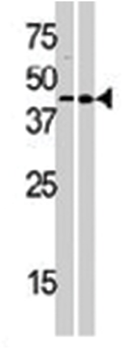 MOS, Rabbit, Polyclonal Antibody, Abnova 400&mu;L; Unlabeled:Antibodies,