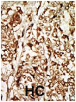MOS, Rabbit, Polyclonal Antibody, Abnova 400&mu;L; Unlabeled:Antibodies,