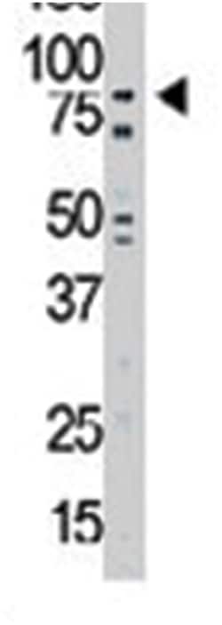 NEK11, Rabbit, Polyclonal Antibody, Abnova 400 &mu;L | Buy Online | Abnova Corporation | Fisher Scientific