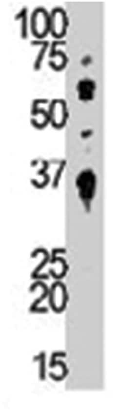NEK1 Rabbit anti-Hamster, Human, Polyclonal Antibody, Abnova 400 &mu;L | Buy Online | Abnova Corporation | Fisher Scientific