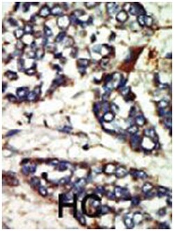 NEK1 Rabbit anti-Hamster, Human, Polyclonal Antibody, Abnova 400 &mu;L | Buy Online | Abnova Corporation | Fisher Scientific