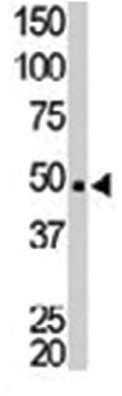 NEK2 Rabbit anti-Human, Polyclonal Antibody, Abnova 400 &mu;L | Buy Online | Abnova Corporation | Fisher Scientific