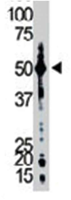 NEK2 Rabbit anti-Human, Mouse, Polyclonal Antibody, Abnova 400 &mu;L | Buy Online | Abnova Corporation | Fisher Scientific