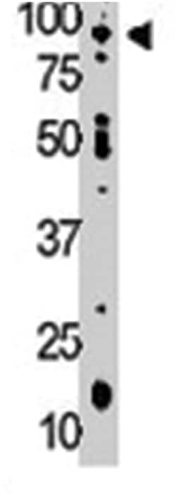 NEK4, Rabbit, Polyclonal Antibody, Abnova 400 &mu;L | Buy Online | Abnova Corporation | Fisher Scientific