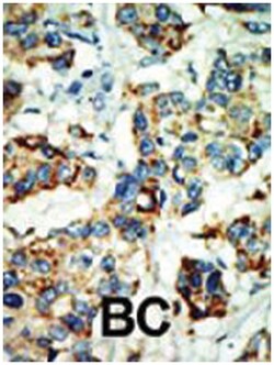 NEK4, Rabbit, Polyclonal Antibody, Abnova 400 &mu;L | Buy Online | Abnova Corporation | Fisher Scientific