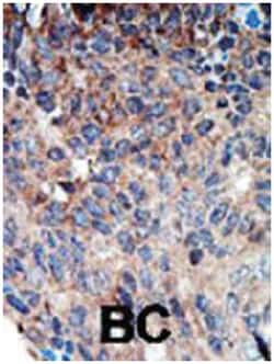 NME1 Rabbit anti-Human, Polyclonal Antibody, Abnova 400&mu;L; Unlabeled:Antibodies,