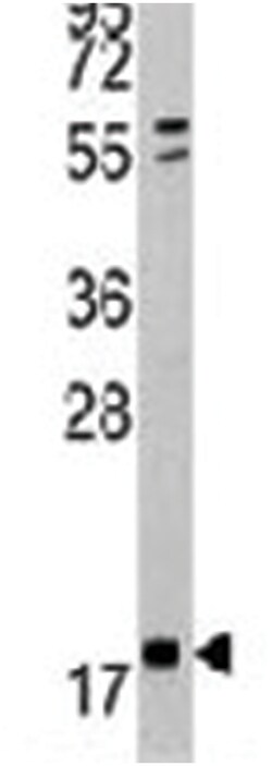 NME2, Rabbit, Polyclonal Antibody, Abnova 400&mu;L; Unlabeled:Antibodies,