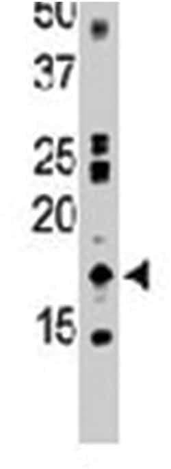 NME2, Rabbit, Polyclonal Antibody, Abnova 400&mu;L; Unlabeled:Antibodies,