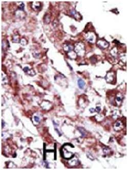 NME7, Rabbit, Polyclonal Antibody, Abnova 400&mu;L; Unlabeled:Antibodies,