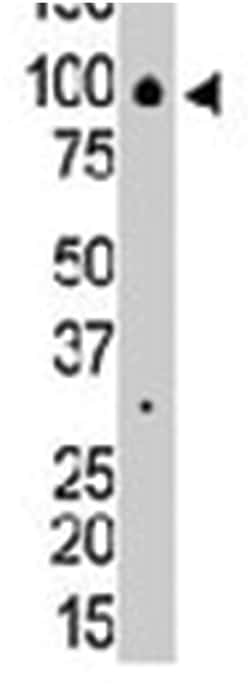 ARHGAP26, Rabbit, Polyclonal Antibody, Abnova 400&mu;L; Unlabeled:Antibodies,