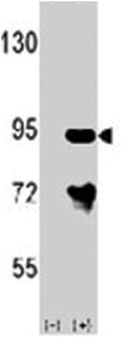 ARHGAP26, Rabbit, Polyclonal Antibody, Abnova 400&mu;L; Unlabeled:Antibodies,