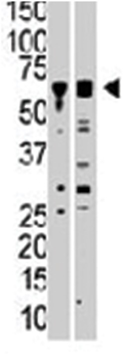 PACSIN1 Rabbit anti-Human, Mouse, Polyclonal Antibody, Abnova 400&mu;L;