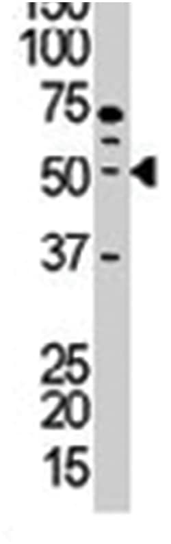 PACSIN1 Rabbit anti-Human, Mouse, Polyclonal Antibody, Abnova 400 &mu;L | Buy Online | Abnova Corporation | Fisher Scientific