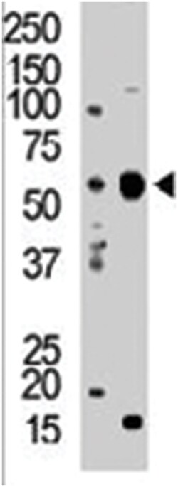 PACSIN2 Rabbit anti-Human, Mouse, Polyclonal Antibody, Abnova 400 &mu;L | Buy Online | Abnova Corporation | Fisher Scientific