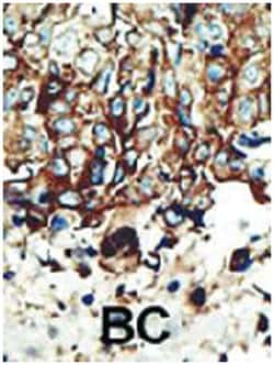 PACSIN2 Rabbit anti-Human, Mouse, Polyclonal Antibody, Abnova 400 &mu;L | Buy Online | Abnova Corporation | Fisher Scientific