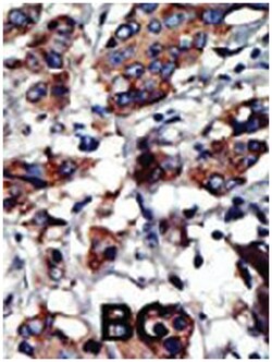 PACSIN3, Rabbit, Polyclonal Antibody, Abnova 400 &mu;L | Buy Online | Abnova | Fisher Scientific